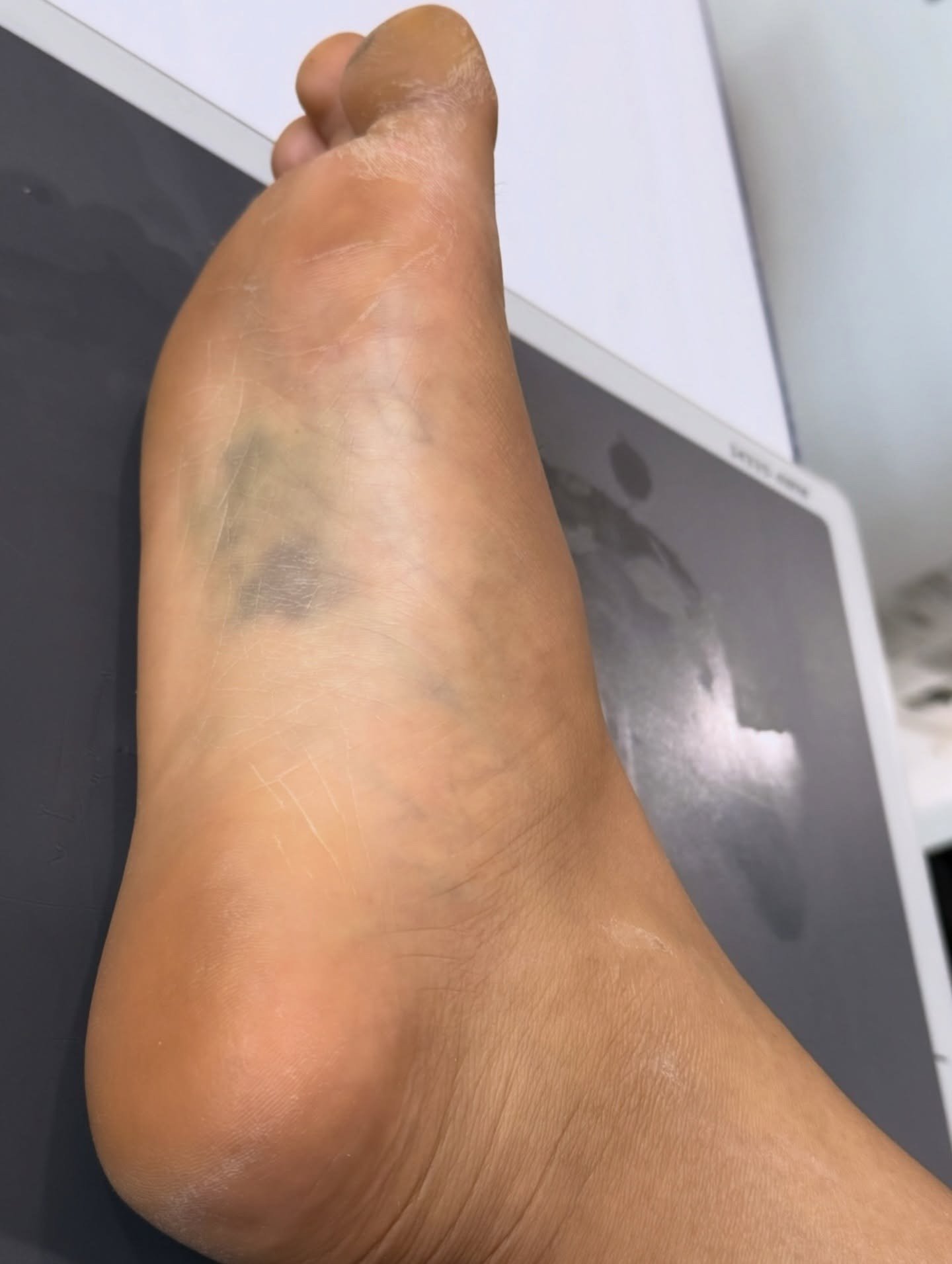 rashmika mandanna feet